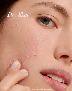 dry skin repair routine showing severe dryness and damaged skin barrier