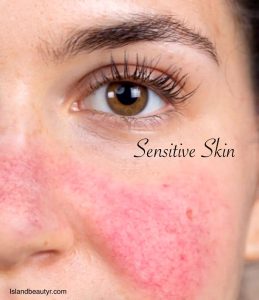 Reactive Skin Barrier Care approach focused on soothing neuro-inflammatory skin responses