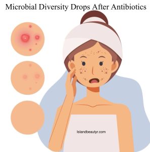 reduced skin bacterial diversity after antibiotic use