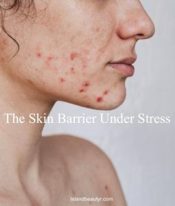 damaged skin barrier caused by microbiome disruption