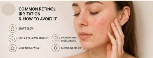 How to avoid retinol irritation with beginner skincare tips to reduce redness, dryness, peeling, and skin sensitivity.
