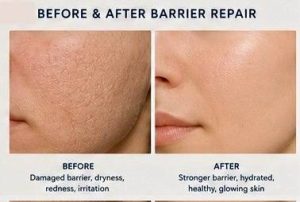 Before and after results of using the Best Ceramide Moisturizers for Barrier Repair to improve skin hydration