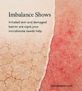 Illustration showing the relationship between the skin microbiome and skin barrier