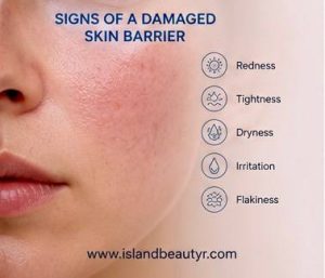 Common signs of a damaged skin barrier include redness, dryness, and skin sensitivity